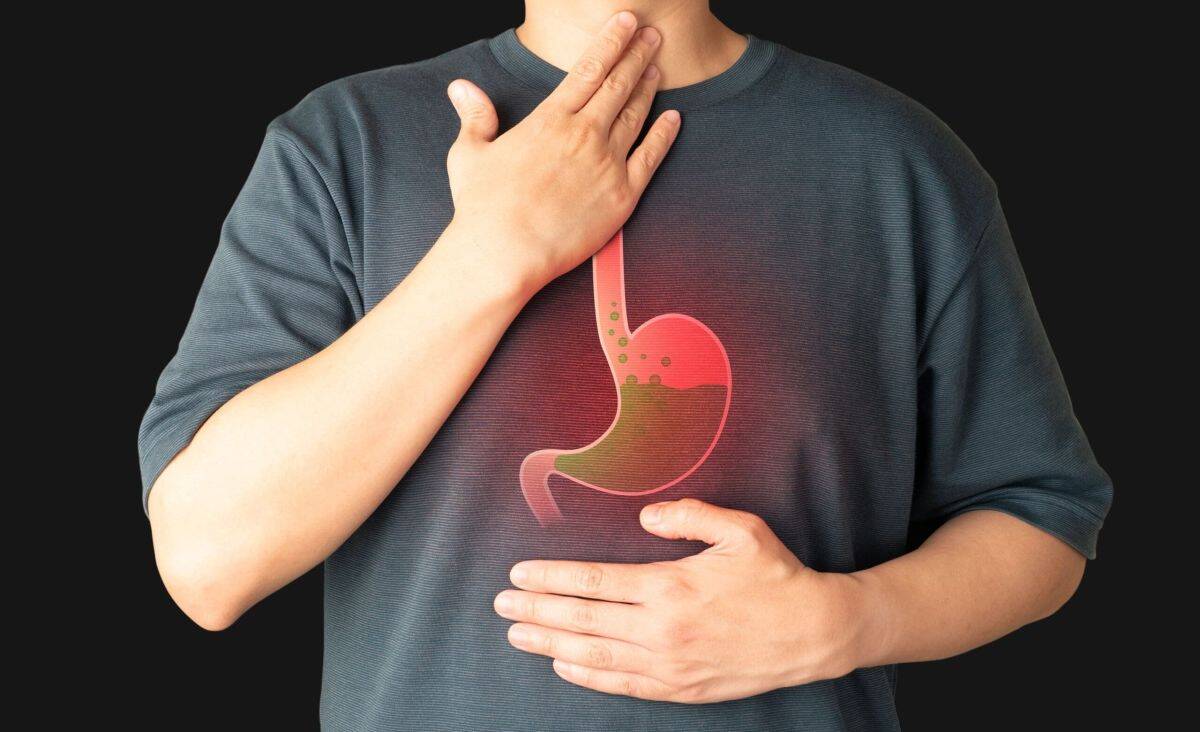 Aciditate Gastrică Tratament Naturist