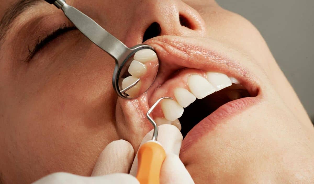 Remedii Abces Dentar și Gingival | Tratament Naturist