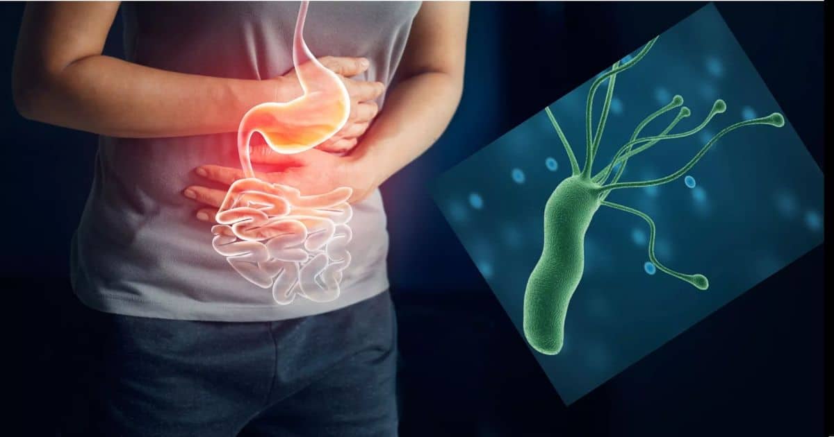Tratamentul Naturist pentru Helicobacter Pylori | Funcționează!