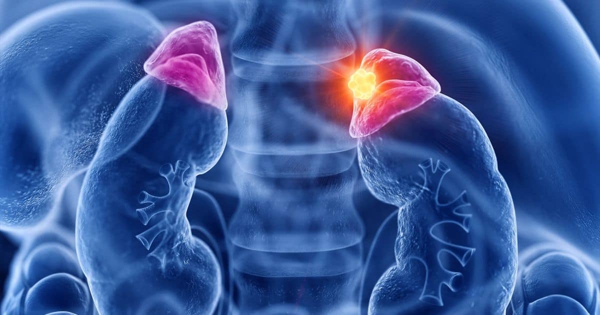 adenom-suprarenal-remedii